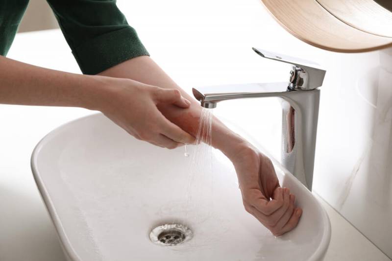 Primeiros socorros para queimadura: o que fazer em emergências